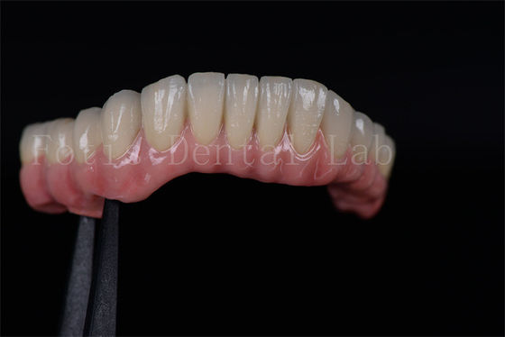 উচ্চ সাফল্যের হার সব চার উপর সব ছয় উপর Zirconia টাইটানিয়াম দাঁত ইমপ্লান্ট কাস্টমাইজড