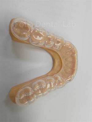 Ergonomic Hard Soft Occlusal Guard Soft Teeth Guard দীর্ঘমেয়াদী ব্যবহার