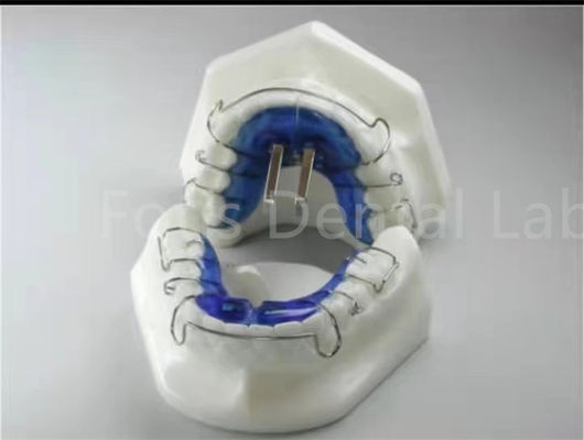 সঠিক দাঁত সমন্বয় জন্য Orthodontic চিকিত্সা রিটেনার এক্সপ্যান্ডার