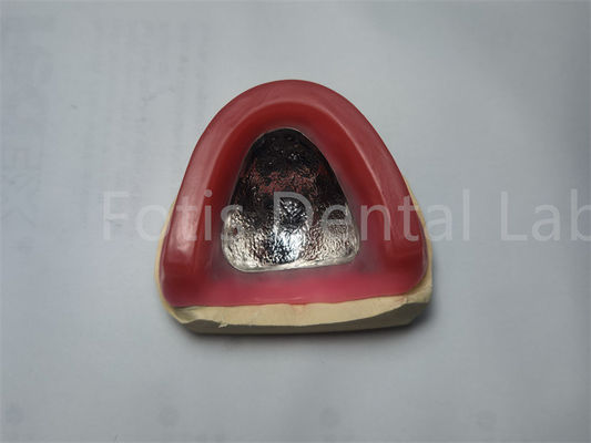 লাল চকচকে দাঁত মোম রিং Occlusal কনট্যুর রিং আরামদায়ক