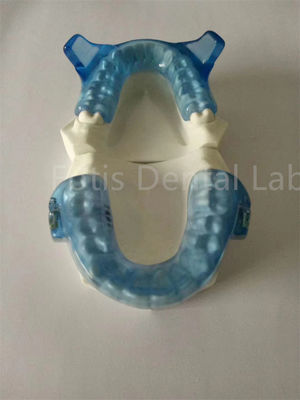 উচ্চতর দাঁত সমন্বয় ফলাফলের জন্য উন্নত Orthodontics যন্ত্রপাতি